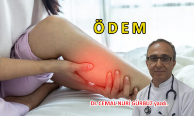 ÖDEM