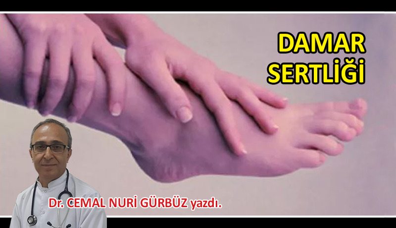 Damar sertliği