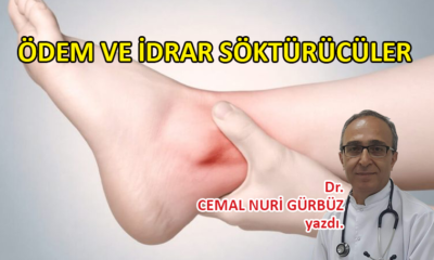 Ödem ve idrar söktürücüler