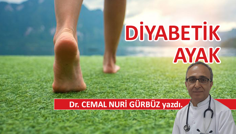 Diyabetik Ayak