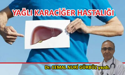 Yağlı Karaciğer Hastalığı