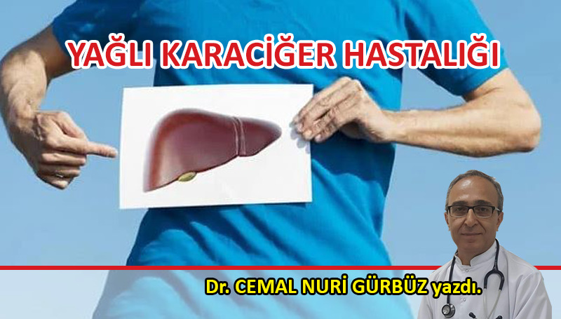 Yağlı Karaciğer Hastalığı