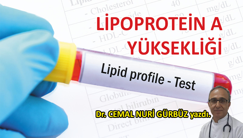 Lipoprotein A Yüksekliği