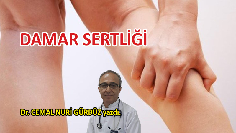 Damar Sertliği