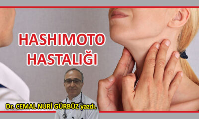 Hashimoto hastalığı