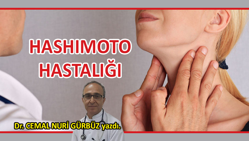 Hashimoto hastalığı