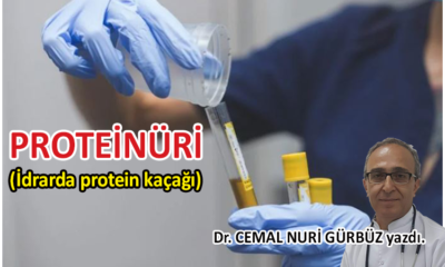 Proteinüri (İdrarda protein kaçağı) 