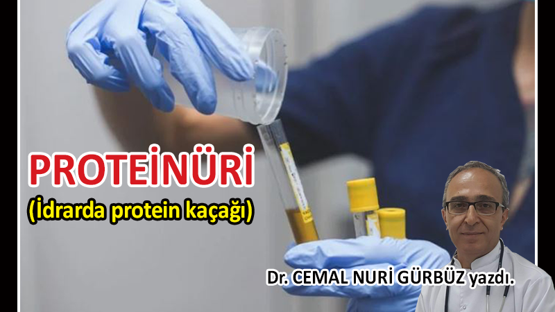Proteinüri (İdrarda protein kaçağı)